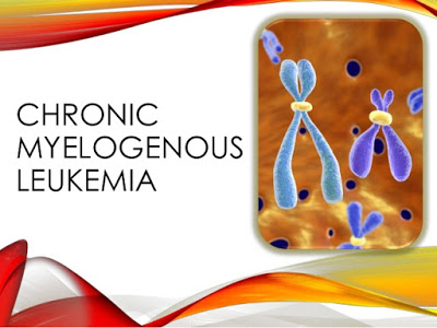 chronic-myeloid-leukemia-1-638.jpg