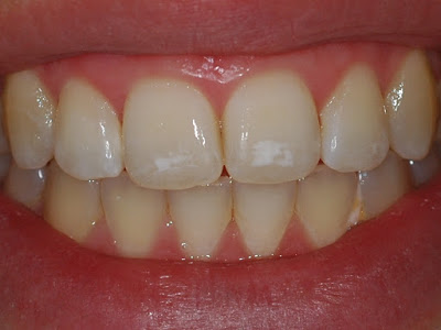 white-1.jpg