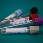 Νέο τεστ αίματος ανιχνεύει 50 τύπους καρκίνου πριν από την εμφάνιση ενδείξεων ή συμπτωμάτων