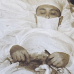 “Πονάει σαν να με τρυπάει ο διάβολος!” Ο Σοβιετικός γιατρός που έκανε στον εαυτό του εγχείρηση σκωληκοειδίτιδας…