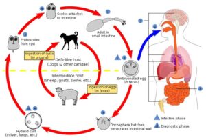 echinococcus-big