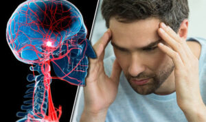 Stroke-headache-migraine-cardiovascular-disease-uk-912960
